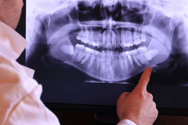 Best Broken Tooth Emergency  in Fairmount, NY