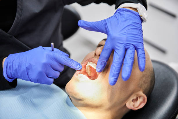 Best Dentist for Tooth Abscess  in Fairmount, NY